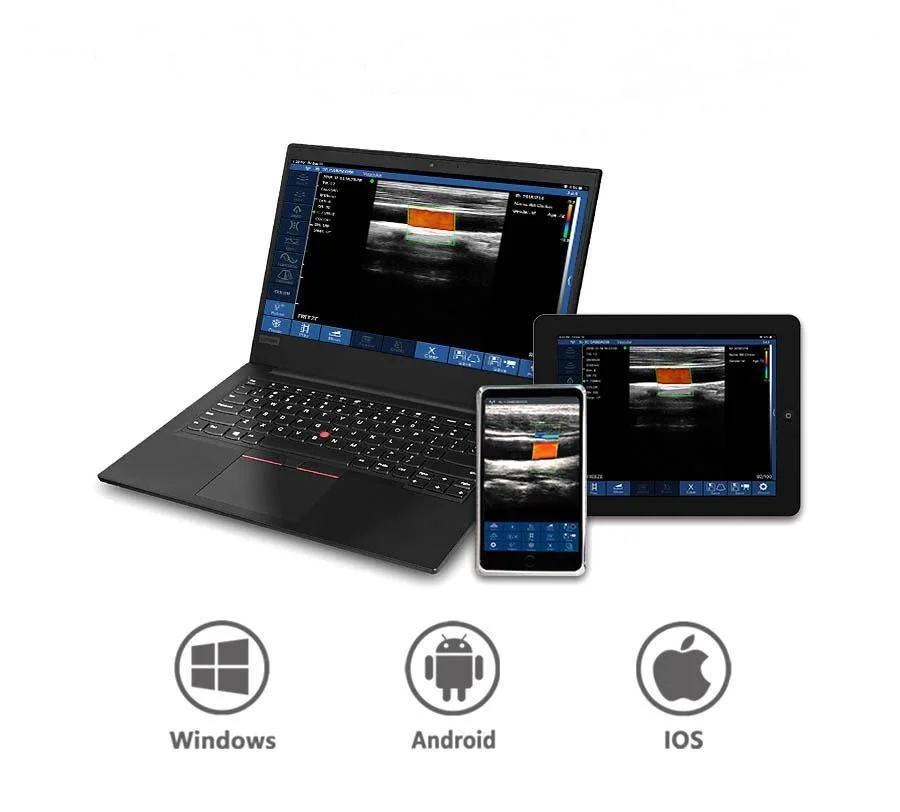Ultrasound-For-Smartphone-1.jpg (1)
